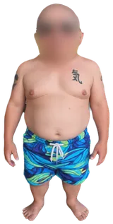 Verne Troyer