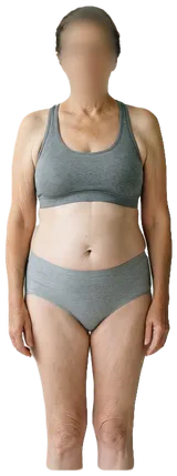 Average sedentary woman, 45