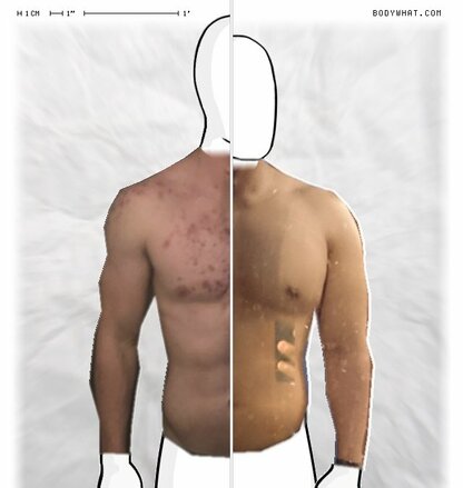 Torso Comparison
