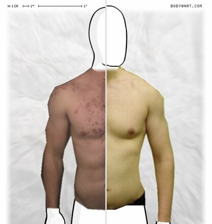 Torso Comparison