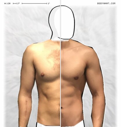 Torso Comparison