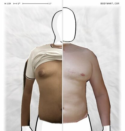 Torso Comparison