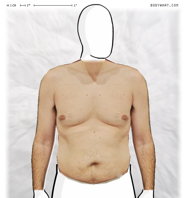 Picture 1