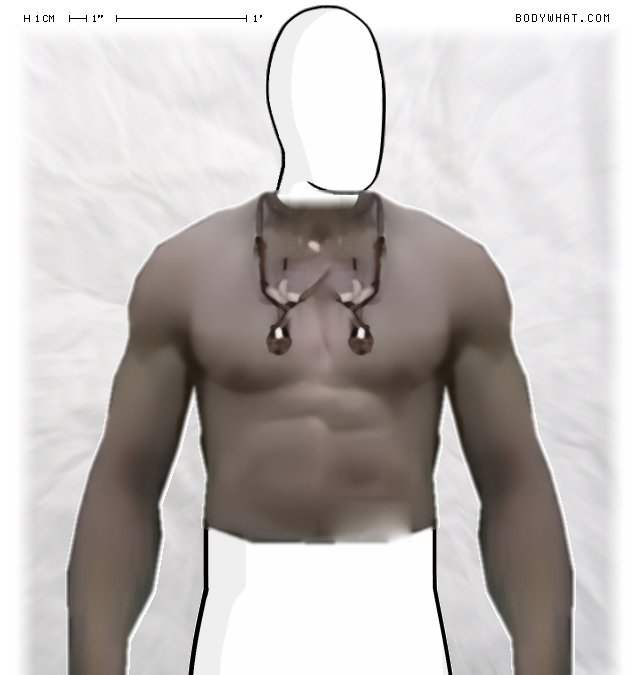 Picture 1
