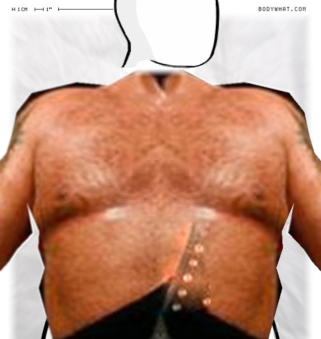 Picture 1