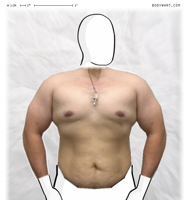 Picture 1