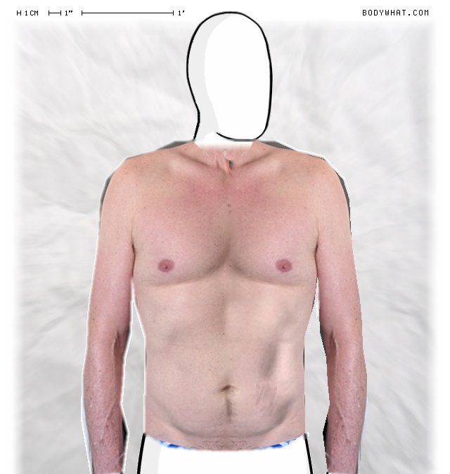 Picture 1