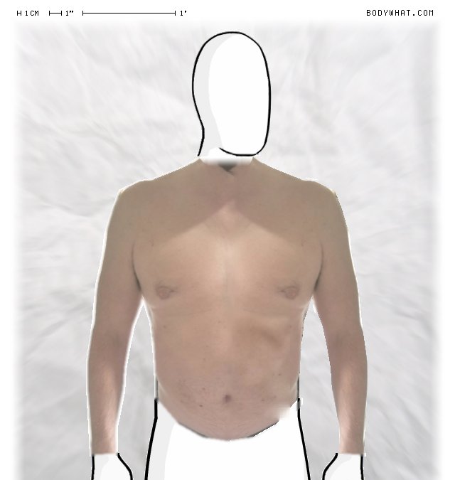 Picture 1
