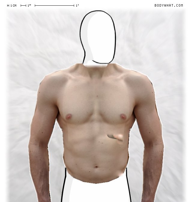 Picture 1