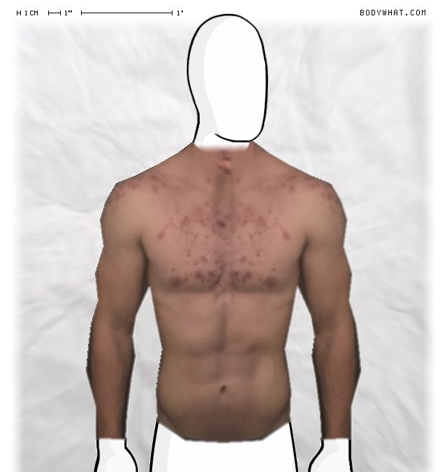 Picture 1