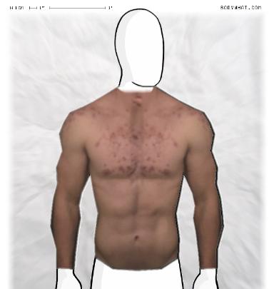 Muscle-ing up