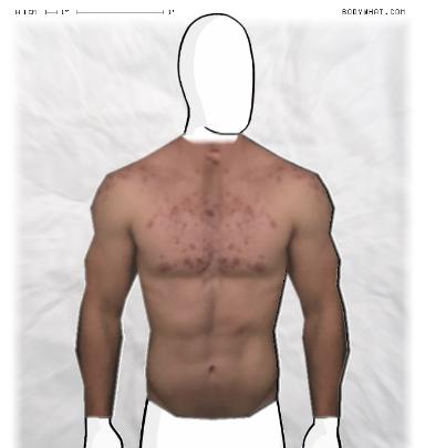 Muscle-ing up