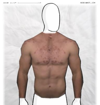 Muscle-ing up