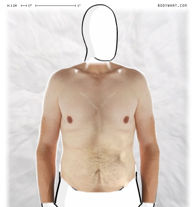 Picture 1