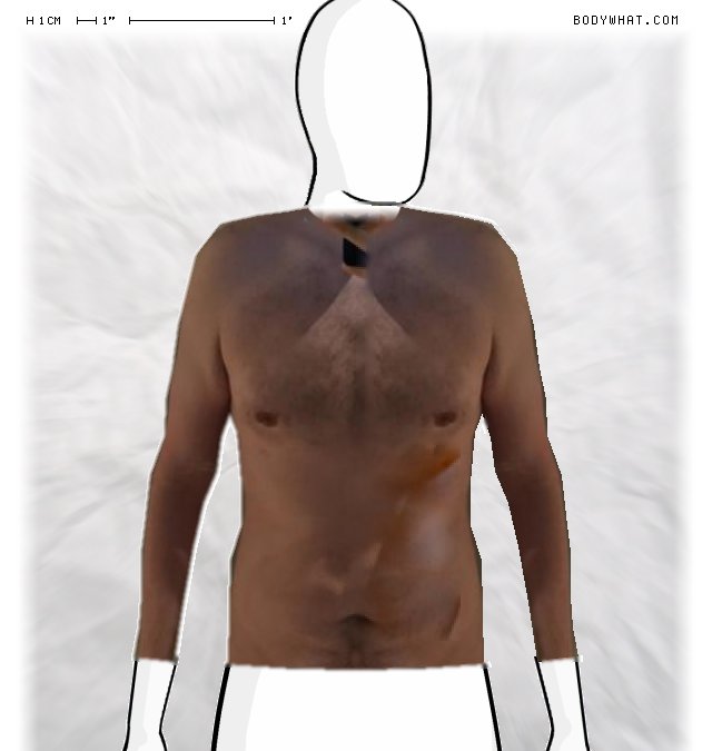 Picture 1