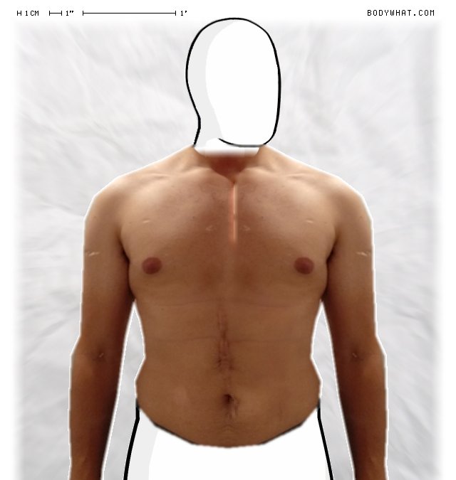 Picture 1
