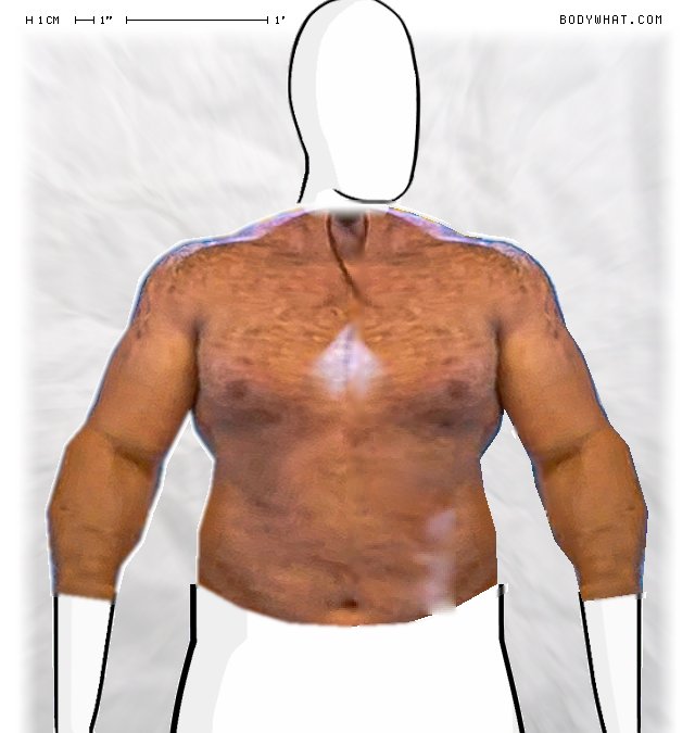 Picture 1