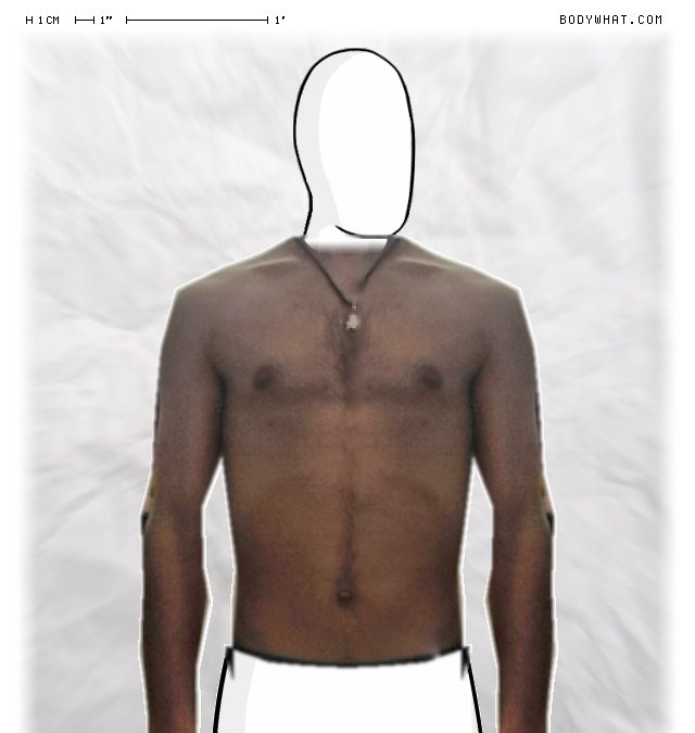 Picture 1