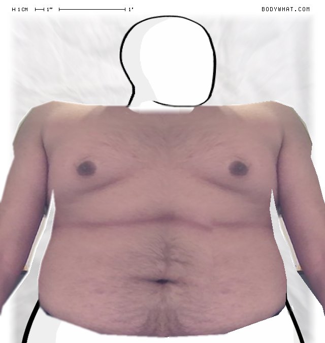 Picture 1