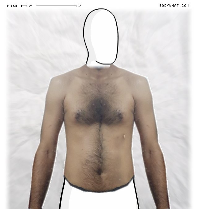 Picture 1