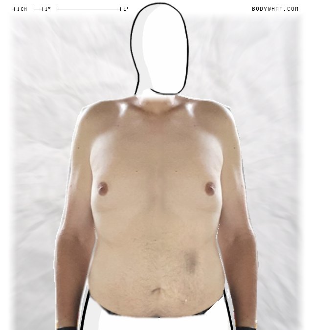 Picture 1