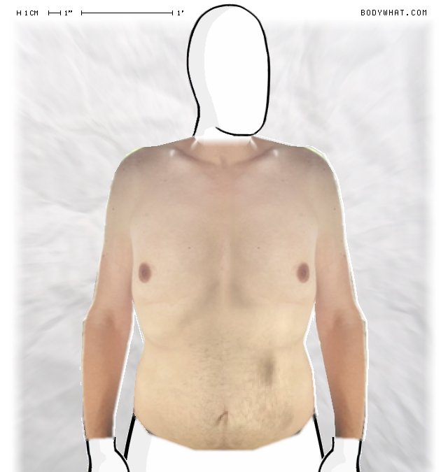 Picture 1