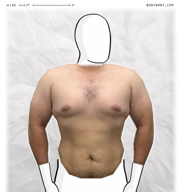 Picture 1