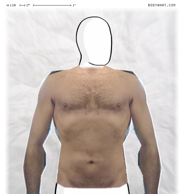 Picture 1