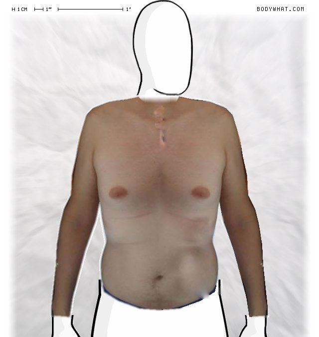 Picture 1