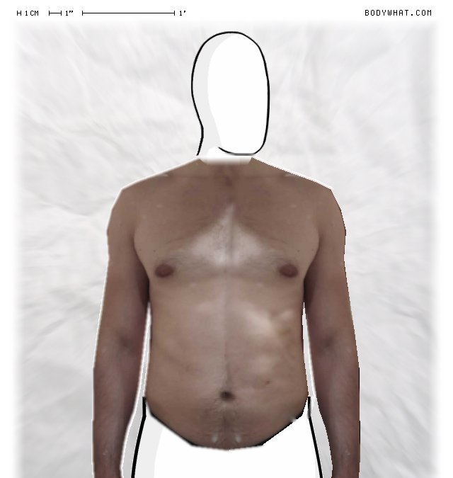 Picture 1