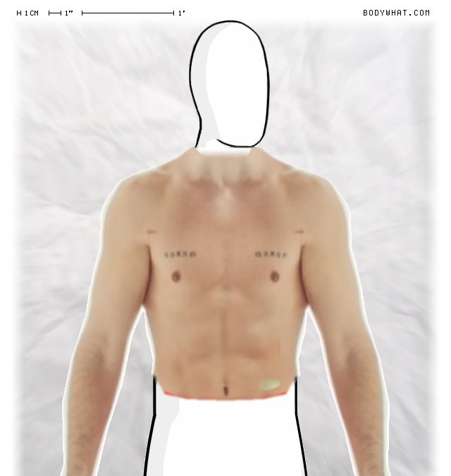 Picture 1