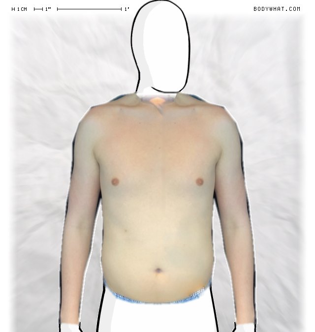Picture 1