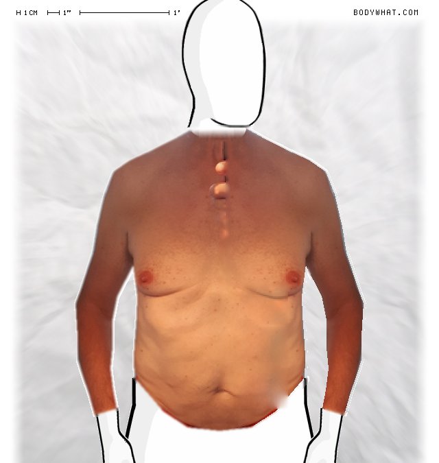 Picture 1