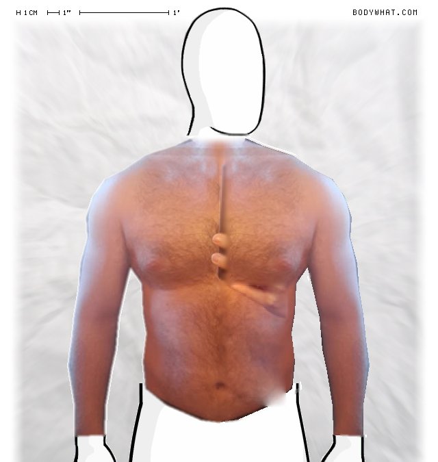 Picture 1