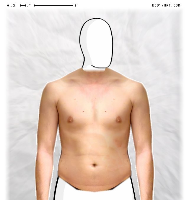Picture 1
