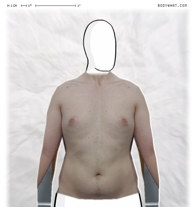 Picture 1