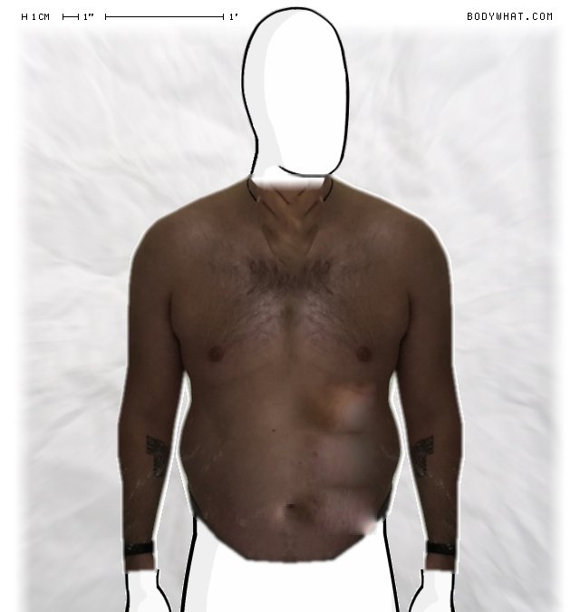 Picture 1