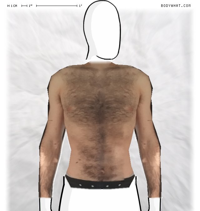 Picture 1