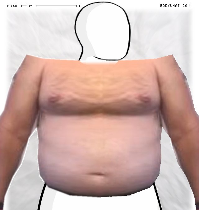 Picture 1