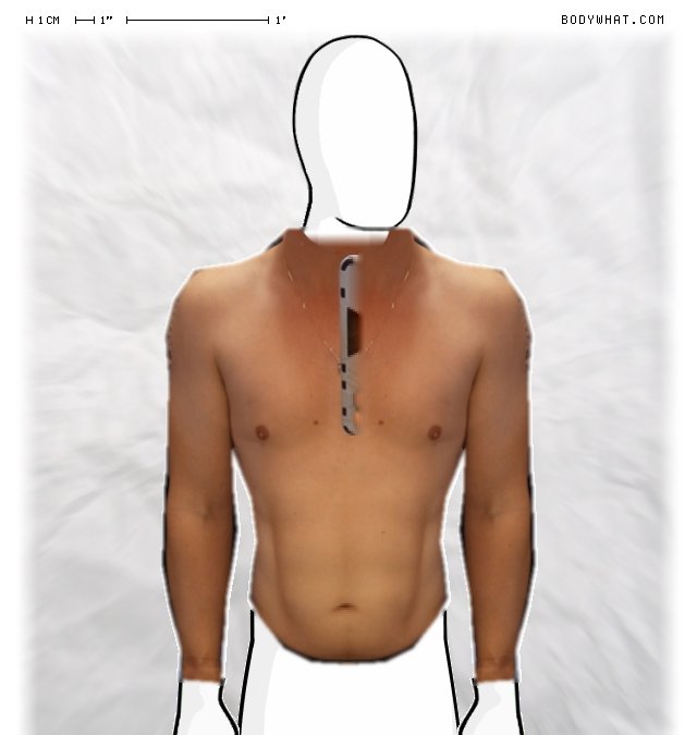 Picture 1