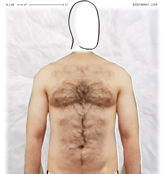 Picture 1